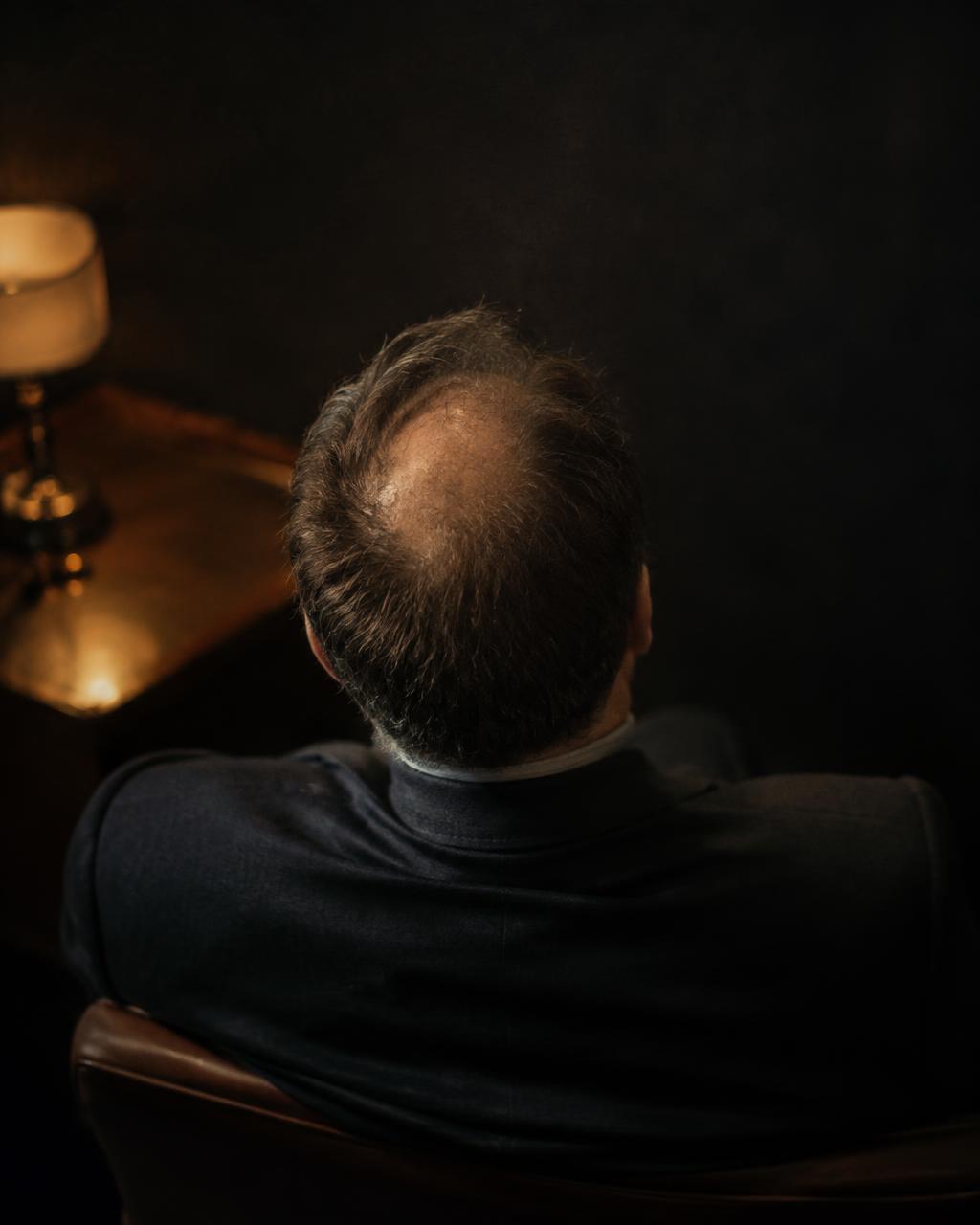 Crown thinning before restoration